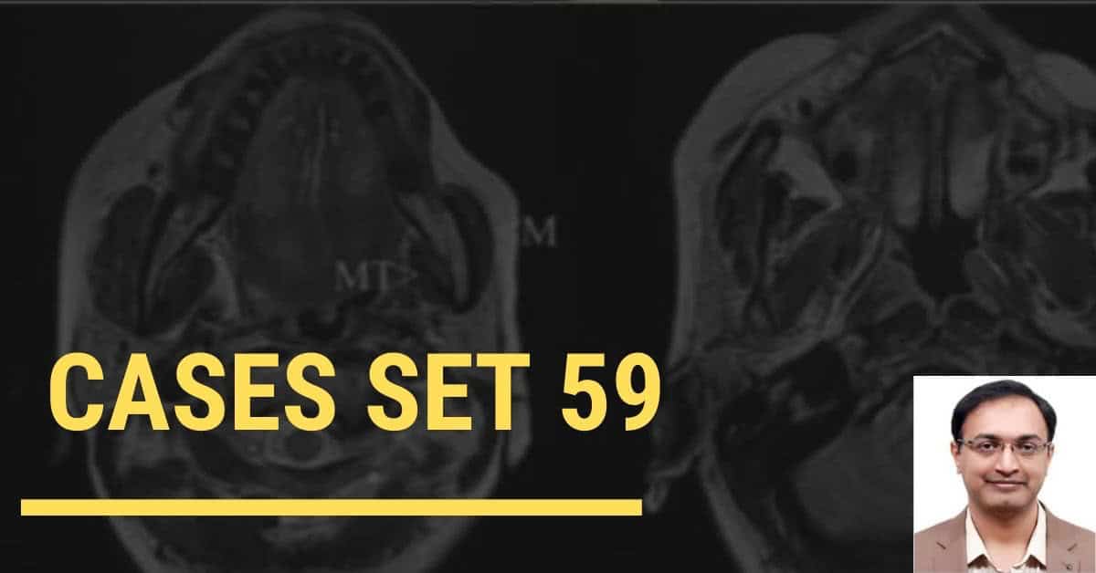 Neuroradiology Cases Spotters Set 59 RadioGyan RadioGyan