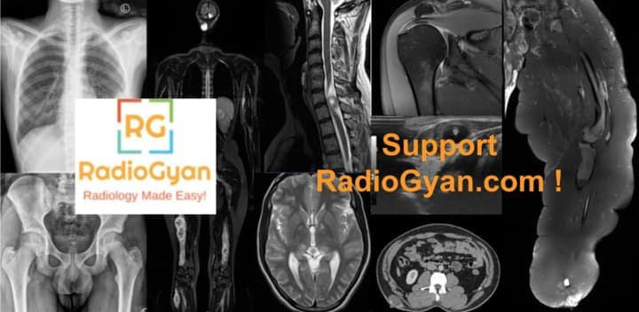 Support RadioGyan,com