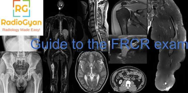 Guide to the FRCR exam RadioGyan.com