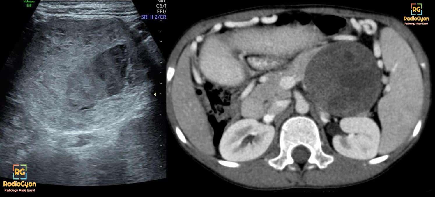 Classic Radiology Cases 3 | Spotters Set 57 | RadioGyan.com - RadioGyan